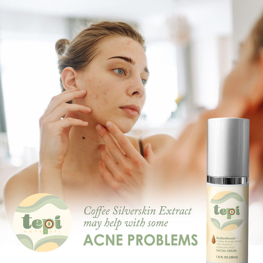 🚨 Can Coffee Silverskin Extract Help with Acne? 🚨